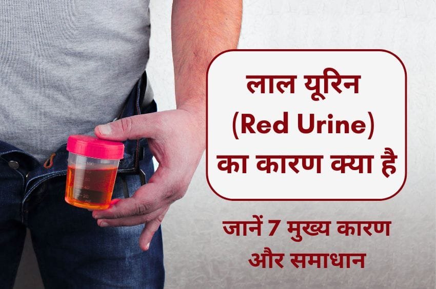 Causes of Red Urine